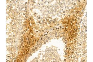 ABIN6265516 and ABIN6272982 at 1/100 staining Rat testis tissue by IHC-P. (TELO2 抗体  (Internal Region))