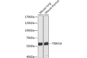Western blot analysis of extracts of various cell lines, using TRIM16 antibody (ABIN7270978) at 1:1000 dilution. (TRIM16 抗体  (AA 1-210))