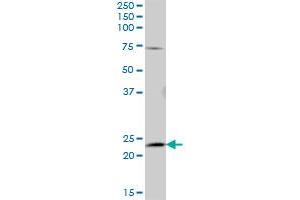 AK5 MaxPab polyclonal antibody. (Adenylate Kinase 5 抗体  (AA 1-536))