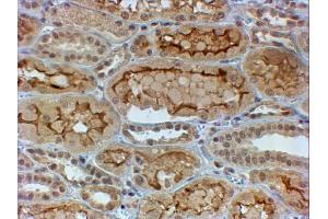 Immunohistochemistry (IHC) image for anti-Collagen, Type IV, alpha 3 (COL4A3) (AA 341-353) antibody (ABIN1781939)