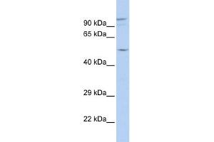WB Suggested Anti-GJA3 Antibody Titration:  0. (GJA3 抗体  (N-Term))
