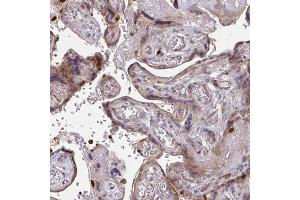 Immunohistochemical staining (Formalin-fixed paraffin-embedded sections) of human placenta with CSF3R polyclonal antibody  shows moderate cytoplasmic positivity in trophoblastic cells. (CSF3R 抗体  (AA 420-543))