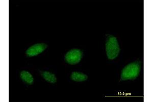 Immunofluorescence of purified MaxPab antibody to ATAD2 on HeLa cell.