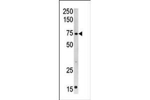 Image no. 1 for anti-Carnitine Palmitoyltransferase 2 (CPT2) (C-Term) antibody (ABIN357771) (CPT2 抗体  (C-Term))