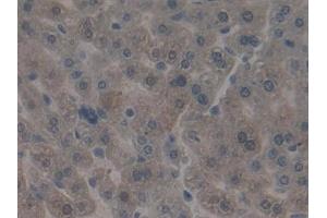 Detection of ITGb5 in Mouse Liver Tissue using Polyclonal Antibody to Integrin Beta 5 (ITGb5) (Integrin beta 5 抗体  (AA 136-378))