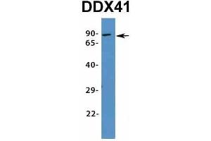 Western Blotting (WB) image for anti-DEAD (Asp-Glu-Ala-Asp) Box Polypeptide 41 (DDX41) (N-Term) antibody (ABIN2775230)