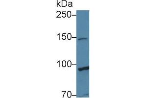 Western Blot; Sample: Human Hela cell lysate; Primary Ab: 1µg/ml Rabbit Anti-Human TAF2 Antibody Second Ab: 0. (TAF2 抗体  (AA 918-1199))