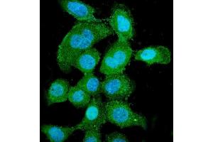 IF analysis of PNP using anti-PNP antibody (ABIN7602997).