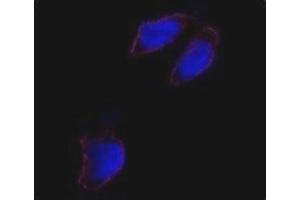 Immunofluorescence analysis of Oct4 antibody and HeLa cells. (OCT4 抗体  (AA 1-30))
