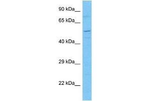 Host:  Rabbit  Target Name:  MP2K7  Sample Type:  293T Whole Cell lysates  Antibody Dilution:  1.