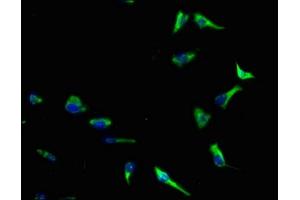 Immunofluorescence staining of SH-SY5Y cells with ABIN7143610 at 1:140, counter-stained with DAPI. (AKTIP 抗体  (AA 1-292))