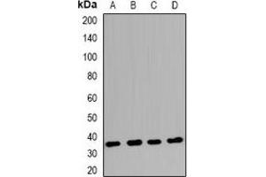 Western blot analysis of Claudin 17 expression in Raji (A), BT474 (B), K562 (C), mouse hrart (D) whole cell lysates. (Claudin 17 抗体  (C-Term))