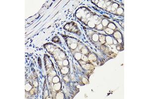 Immunohistochemistry (IHC) image for anti-Cyclin-Dependent Kinase 1 (CDK1) antibody (ABIN7266576)