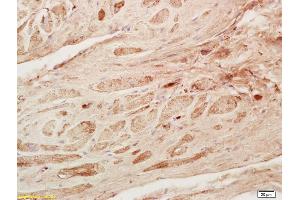 Immunohistochemistry (IHC) image for anti-Myostatin (MSTN) (AA 281-375) antibody (ABIN674469)