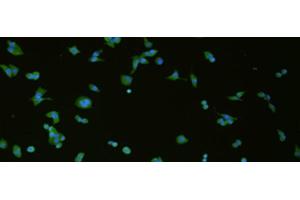 Immunofluorescence analysis of hela cell using SLC18A3 Polyclonal Antibody at dilution of 1:50 (SLC18A3 抗体)
