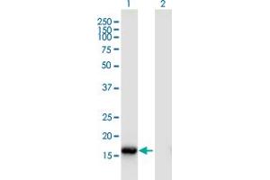 Western Blot analysis of ROBO3 expression in transfected 293T cell line by ROBO3 monoclonal antibody (M02), clone 2H1. (ROBO3 抗体  (AA 1-147))
