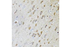 Immunohistochemistry of paraffin-embedded rat brain using MT-ND5 antibody (ABIN6135116, ABIN6144435, ABIN6144437 and ABIN6224158) at dilution of 1:100 (40x lens). (MT-ND5 抗体  (AA 500-600))