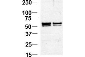 Western blot analysis of NL1 Antibody (N-term) 920b in Jurkat cell lysates. (NAP1L1 抗体  (N-Term))