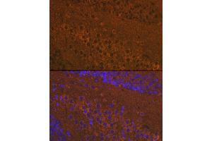 Immunofluorescence analysis of mouse brain using Mu Opioid Receptor(MOR) Rabbit pAb (ABIN7269101) at dilution of 1:100 (40x lens). (Mu Opioid Receptor 1 抗体  (C-Term))