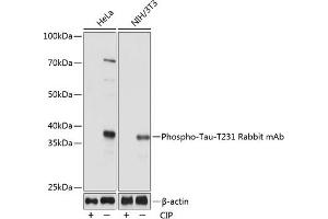 Western blot analysis of extracts of various cell lines, using Phospho-Tau-T231 Rabbit mAb (ABIN7268531) at 1:1000 dilution. (MAPT 抗体  (pThr231))