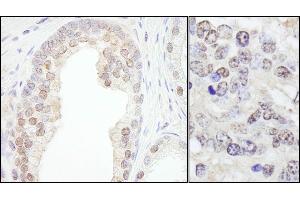 anti-Tripartite Motif Containing 33 (TRIM33) (C-Term) antibody