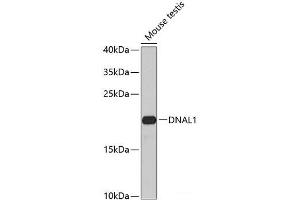 Western blot analysis of extracts of Mouse testis using DNAL1 Polyclonal Antibody at dilution of 1:1000. (DNAL1 抗体)