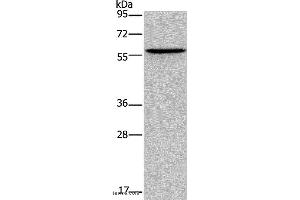 Western blot analysis of Human lung cancer tissue, using ADRA1B Polyclonal Antibody at dilution of 1:550 (ADRA1B 抗体)