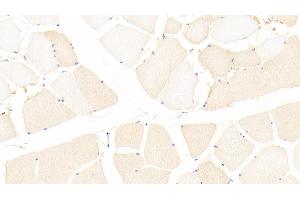 Detection of CCDC80 in Human Skeletal muscle Tissue using Polyclonal Antibody to Coiled Coil Domain Containing Protein 80 (CCDC80) (CCDC80 抗体  (AA 81-258))