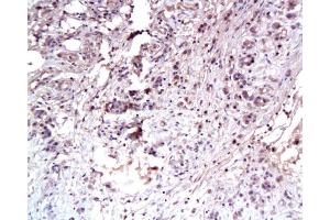 Immunohistochemistry (Paraffin-embedded Sections) (IHC (p)) image for anti-Met Proto-Oncogene (MET) (AA 25-150) antibody (ABIN671661)