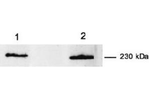 Western Blotting (WB) image for anti-Myoferlin (MYOF) antibody (ABIN1108357) (Myoferlin 抗体)