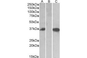 HEK293 lysate (10ug protein in RIPA buffer) over expressing Human CMA1 with DYKDDDDK tag probed with ABIN768626 (0. (CMA1 抗体  (Internal Region))