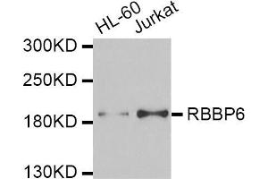 Western blot analysis of extracts of various cell lines, using RBBP6 antibody (ABIN5974190) at 1/1000 dilution. (RBBP6 抗体)