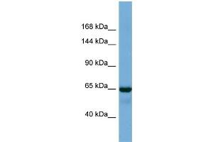 Host:  Rabbit  Target Name:  DKFZp686A1782  Sample Type:  Fetal Lung lysates  Antibody Dilution:  1. (PHC1 抗体  (C-Term))
