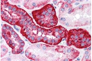 Human Kidney: Formalin-Fixed, Paraffin-Embedded (FFPE) (EpCAM 抗体)