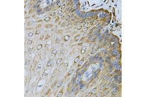 Immunohistochemistry (Paraffin-embedded Sections) (IHC (p)) image for anti-Heat Shock Protein 90kDa alpha (Cytosolic), Class B Member 1 (HSP90AB1) (AA 1-300) antibody (ABIN3021406)