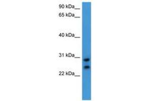 Image no. 1 for anti-Carcinoembryonic Antigen-Related Cell Adhesion Molecule 7 (CEACAM7) (AA 142-191) antibody (ABIN6746761) (CEACAM7 抗体  (AA 142-191))