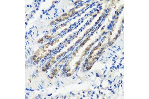 Immunohistochemistry of paraffin-embedded mouse lung using KMT2E antibody (ABIN6131786, ABIN6142983, ABIN6142984 and ABIN6221745) at dilution of 1:200 (40x lens). (MLL5/KMT2E 抗体  (AA 200-500))