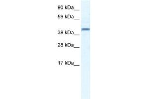 WB Suggested Anti-ANXA7 Antibody Titration:  2. (Annexin VII 抗体  (N-Term))