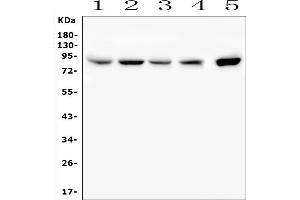 Western blot analysis of SMURF2 using anti-SMURF2 antibody (ABIN7601239).