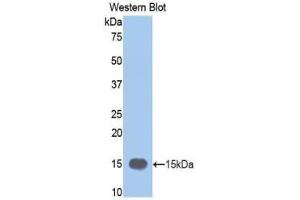 Western blot analysis of the recombinant protein. (MMP12 抗体  (AA 270-362))