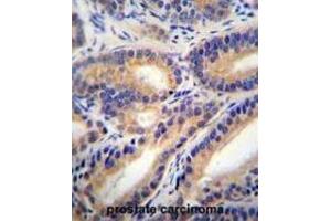 Immunohistochemistry (IHC) image for anti-Hydroxysteroid (11-Beta) Dehydrogenase 1-Like (HSD11B1L) antibody (ABIN2996215) (HSD11B1L 抗体)