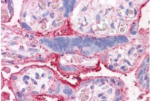Anti-CTR1 antibody  ABIN960806 IHC staining of human placenta.