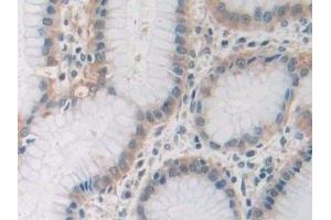 Immunohistochemistry (IHC) image for anti-Sirtuin 4 (SIRT4) (AA 28-314) antibody (ABIN7435928)