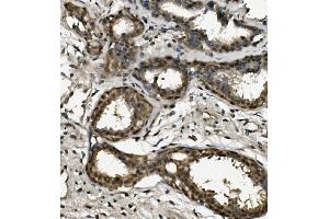 IHC analysis of RPA32/RPA2 using anti-RPA32/RPA2 antibody (ABIN7601380). (RPA2 抗体  (AA 34-254))