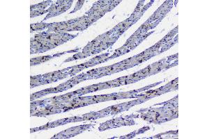 Immunohistochemistry (IHC) image for anti-Integrin, alpha 5 (ITGA5) (AA 42-263) antibody (ABIN5693202)