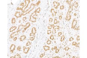 Immunohistochemistry (IHC) image for anti-Replication Protein A2, 32kDa (RPA2) (C-Term) antibody (ABIN7454599)