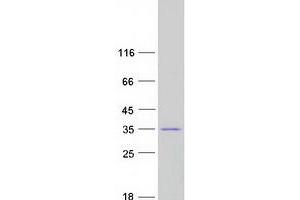Western Blotting (WB) image for Charged Multivesicular Body Protein 2B (CHMP2B) protein (Myc-DYKDDDDK Tag) (ABIN2713982)