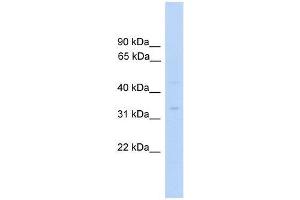 MTFMT antibody used at 0. (MTFMT 抗体  (C-Term))