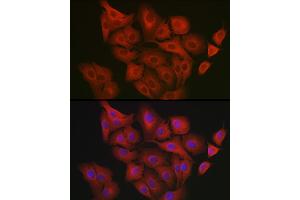 Immunofluorescence analysis of  cells using GART Rabbit pAb (ABIN1679954, ABIN3018225, ABIN3018226 and ABIN6220407) at dilution of 1:200 (40x lens). (GART 抗体  (AA 1-320))