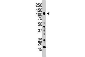 The UBA1 polyclonal antibody  is used in Western blot to detect UBA1 in HL-60 cell lysate. (UBA1 抗体  (C-Term))